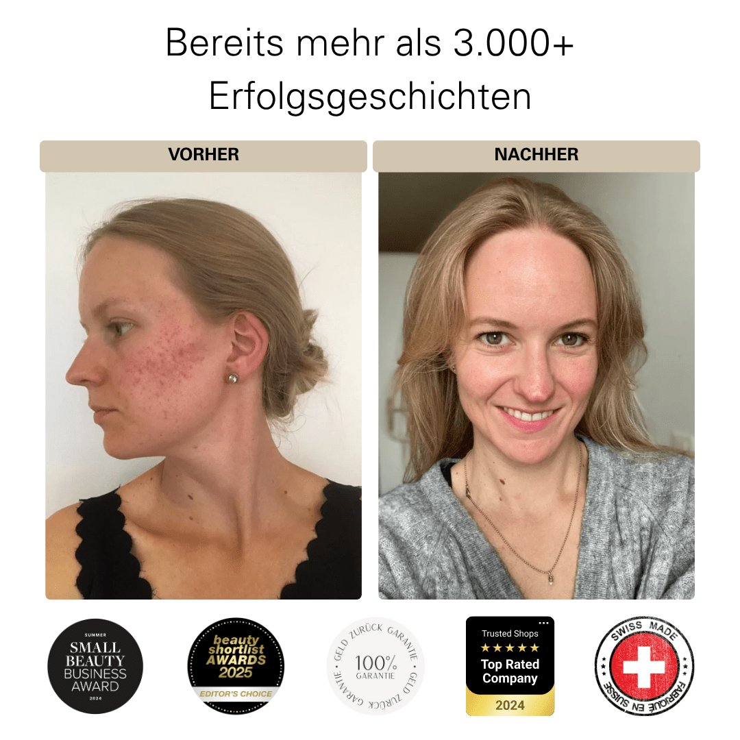 Vorher-Nachher-Vergleich einer Frau mit Hautverbesserung durch RELAXING RITUAL Badesalz – über 3.000 Erfolgsgeschichten und Auszeichnungen.